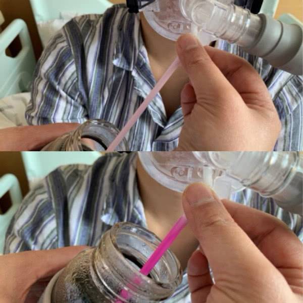 上海护理的一个小发明让重症患者戴着呼吸机也能便利喝水